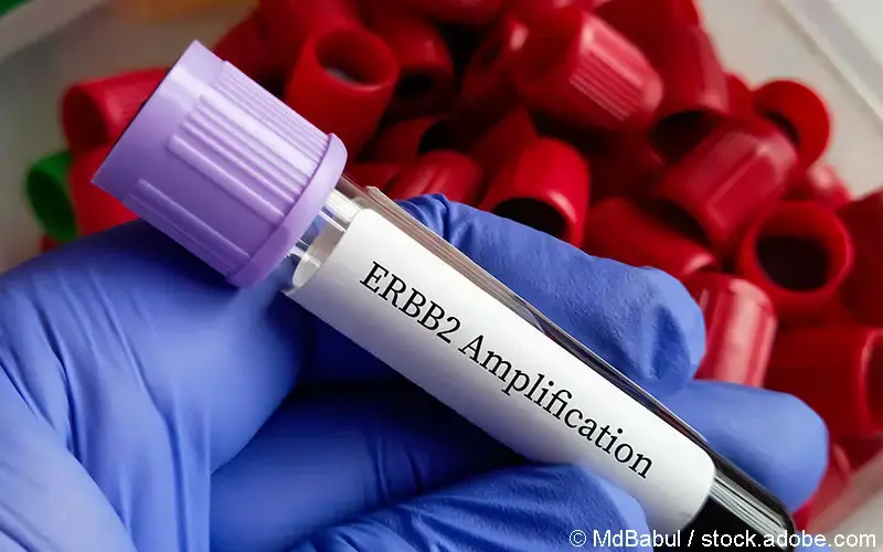 ERBB2-Testung