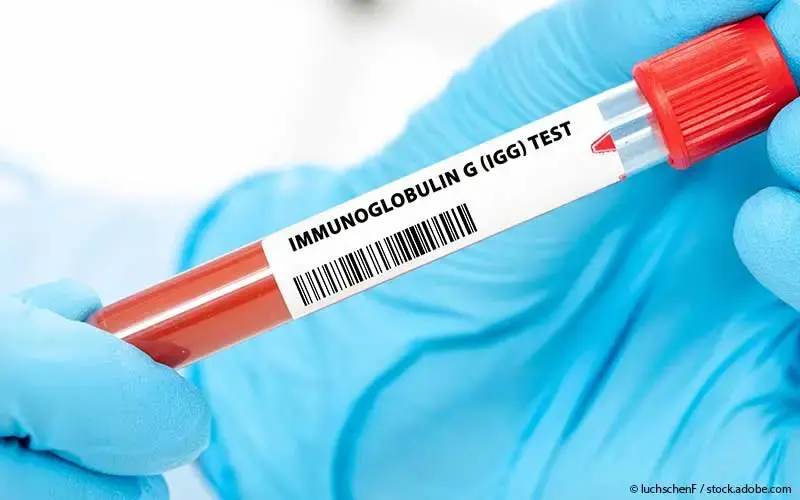 Igg-Testung