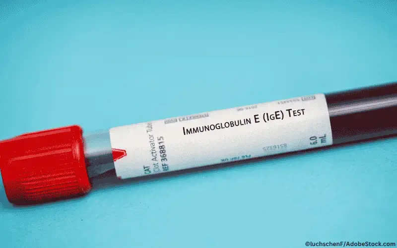 Immunglobulin-E-IgE