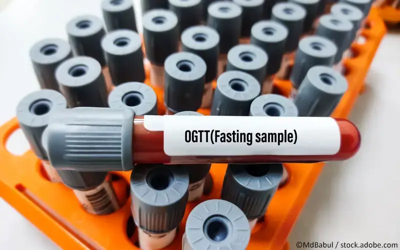oGTT
