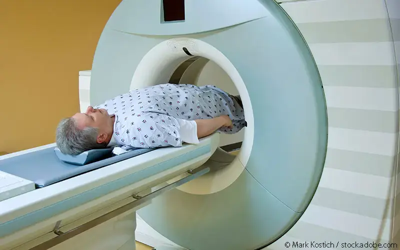 Prostata-CT