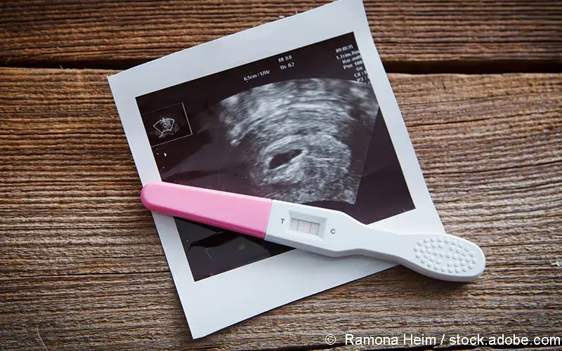 Schwangerschaftstest 2