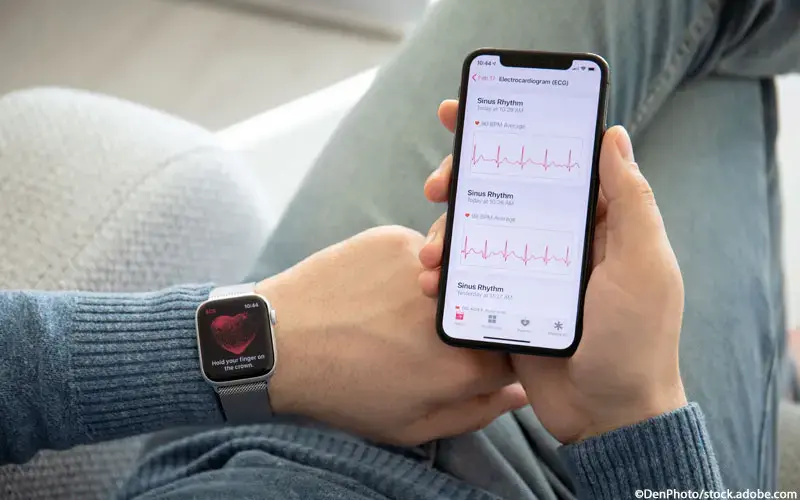 Smartwatch EKG
