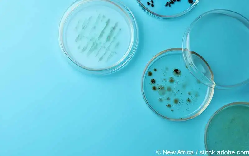 Abstriche Petrischale