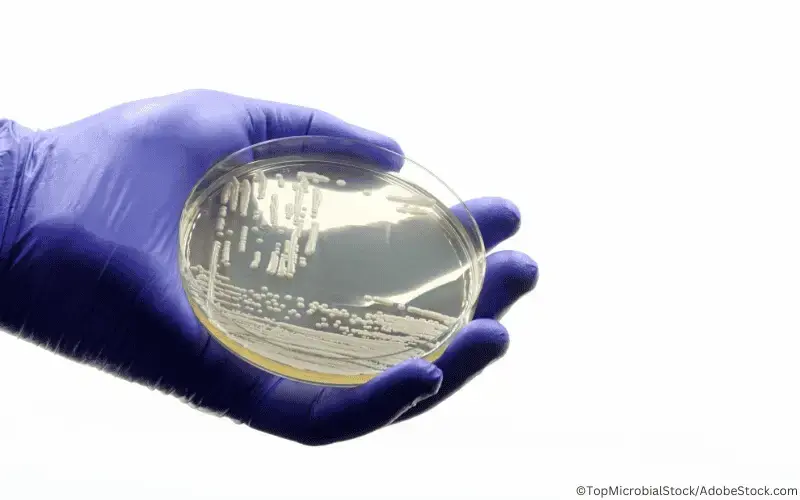 candida-auris-kultur-petrischale