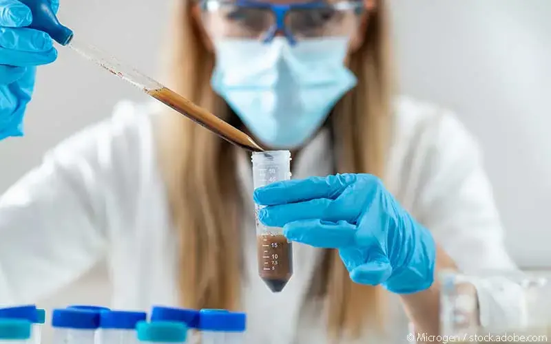 Vorbereitung faekale Transplantation