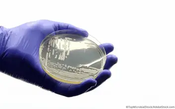 candida-auris-kultur-petrischale candida-auris-kultur-petrischale