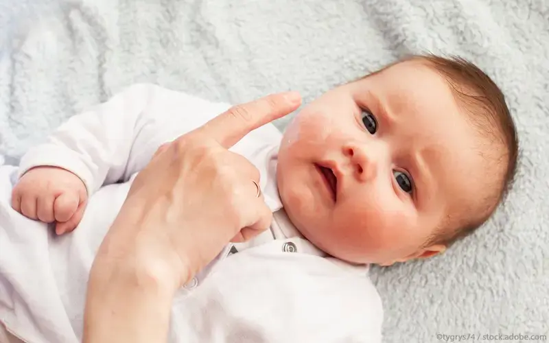 Baby Neurodermitis-Behandlung