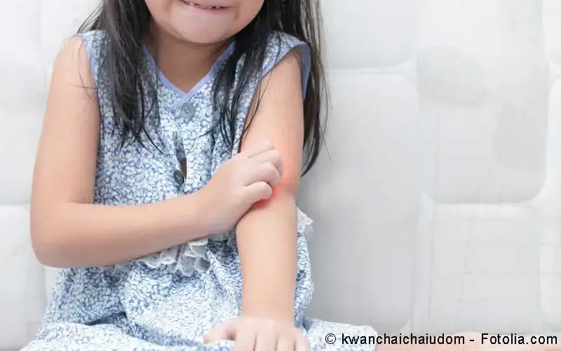 Kind Hautjucken