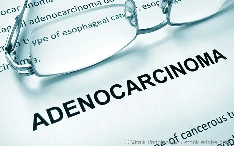 Adenokarzinom Schriftzug