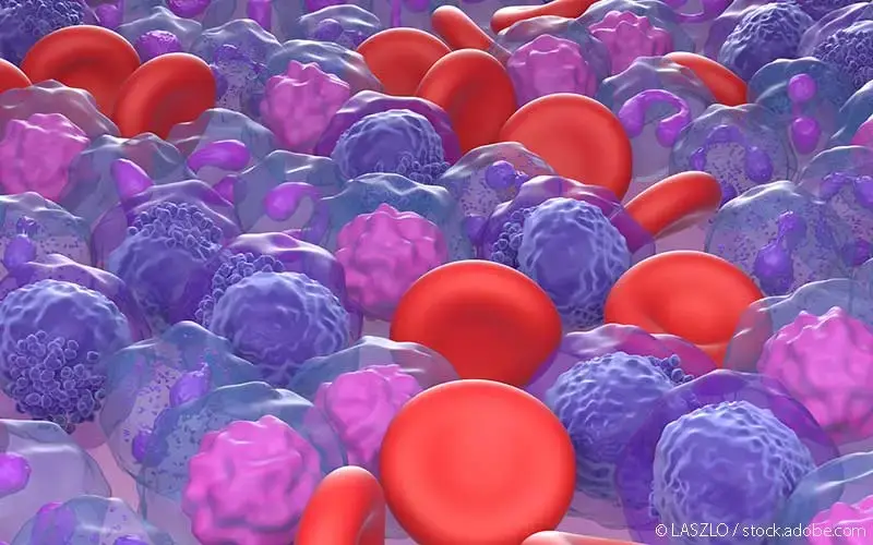 Akute myeloische Leukämie