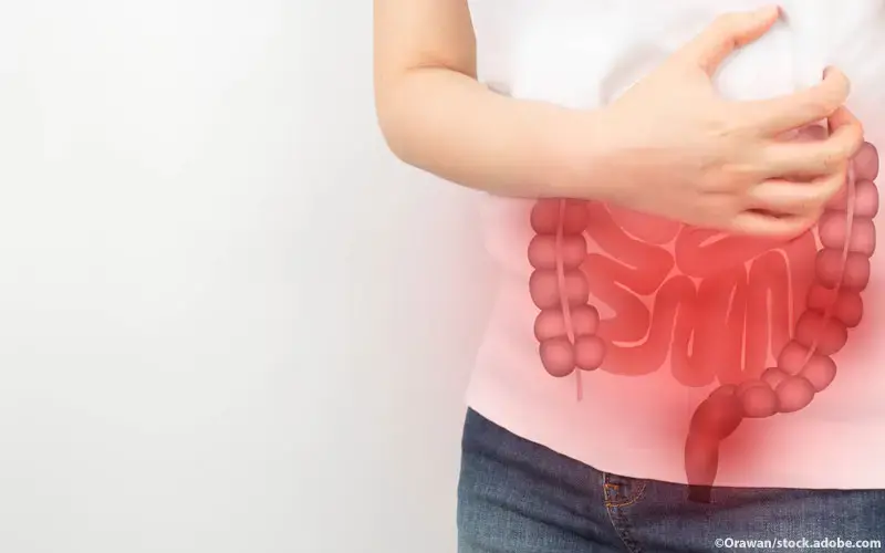 Darmerkrankung