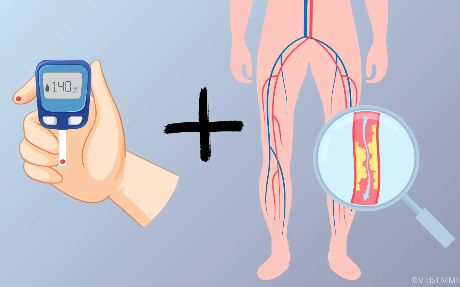 DDG 20 Diabetes und periphere arterielle Verschlusskrankheit ...