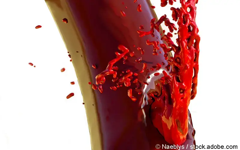 Haemorrhagischer Schlaganfall