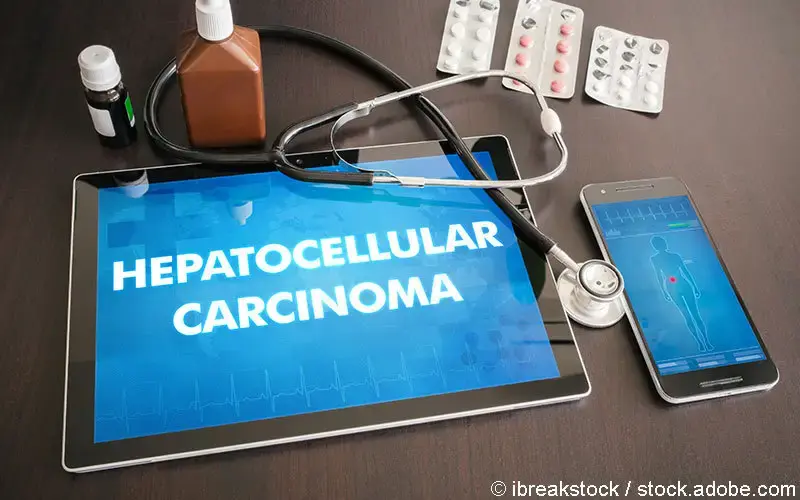 Hepatocellulaeres Karzinom