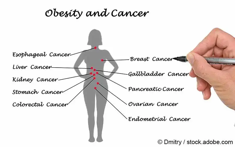 Krebs und Adipositas