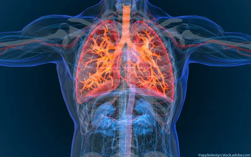 Lungenerkrankung