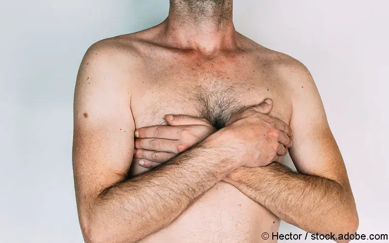 Mann Brustkrebs
