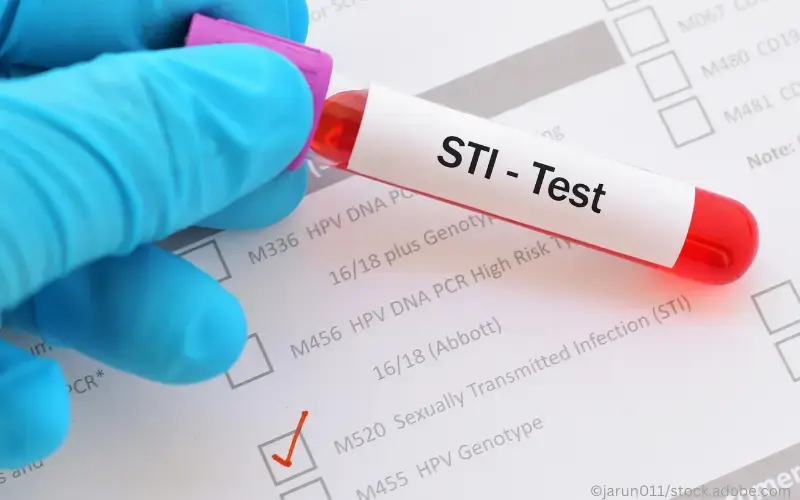 STI Test