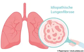 Idiopatische Lungenfibrose Idiopatische Lungenfibrose