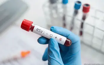 RSV Blut RSV Blut