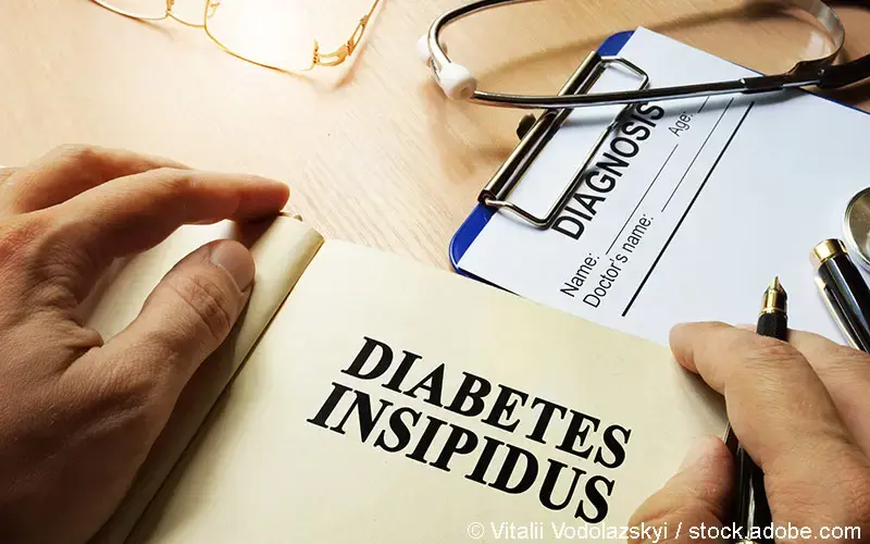 Diabetes insipidus