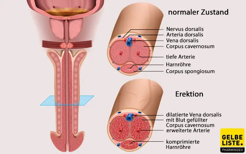 Erektile Dysfunktion