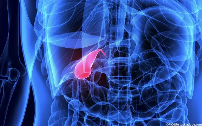 Gallenblasenkarzinom