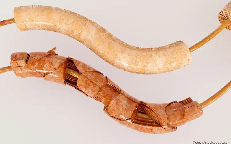 Guillain-Barre-Syndrom