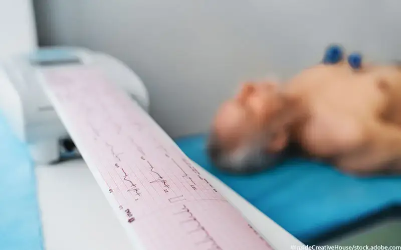 Herzrhythmusstörungen EKG