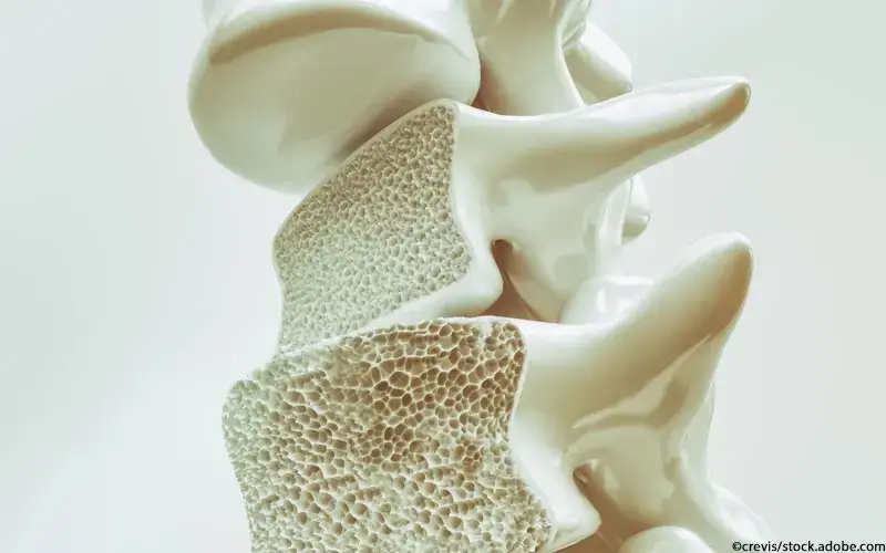 Osteoporose Knochen