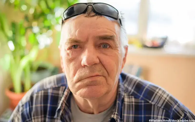 Periphere Fazialisparese