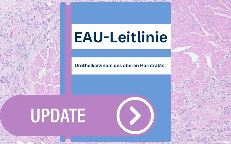 EAU-Leitlinie Urothelkarzinom