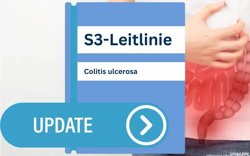 Leilinie colitis kinder