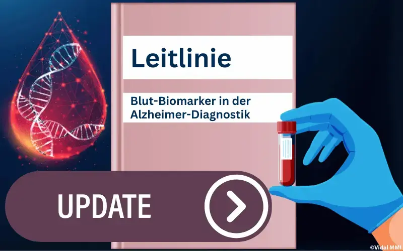 Leitlinie Blutbiomarker Alzheimer