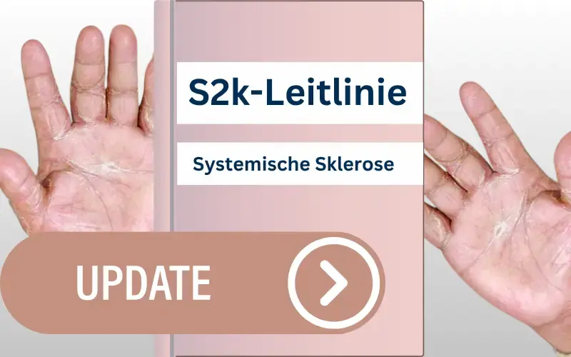 S2k-Leitlinie-systemische-Sklerose