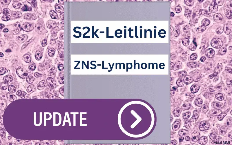 S2k-ZNS-Lymphome