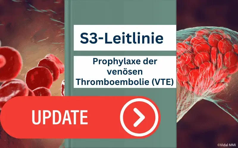 S3-Leitlinie-VTE