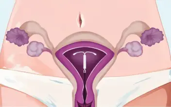 LeitMed Campus CME LNG-IUS LeitMed Campus CME LNG-IUS