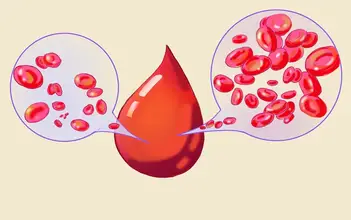 LeitMed Campus Eisenmangel LeitMed Campus Eisenmangel