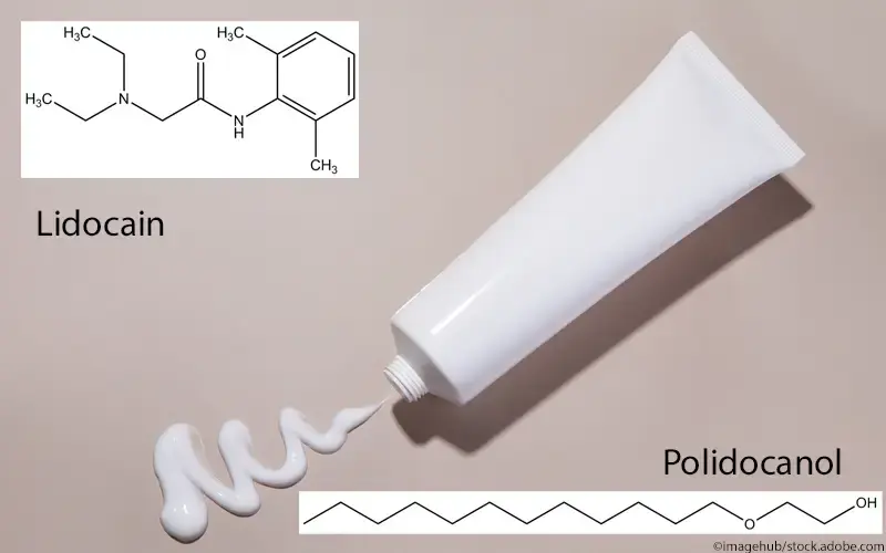 Lidocain Polidocanol