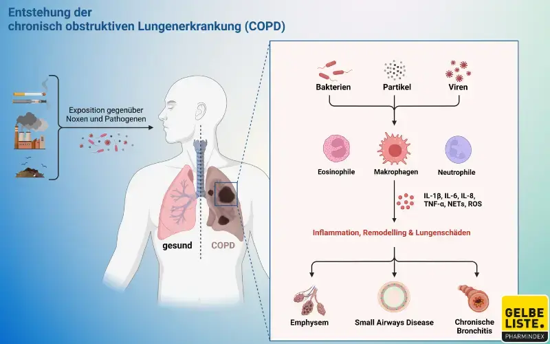 COPD Entstehung
