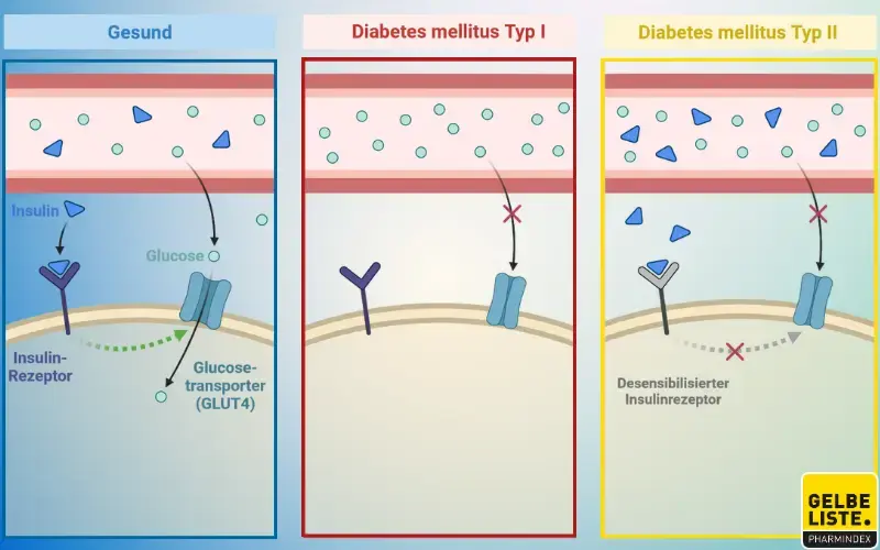 Diabetes mellitus I und II