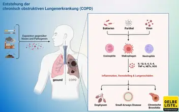COPD Entstehung COPD Entstehung
