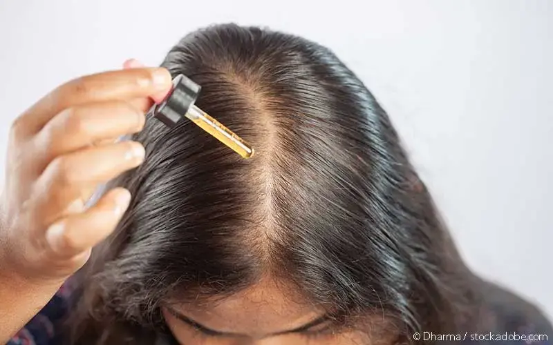 Frau Minoxidil Applikation