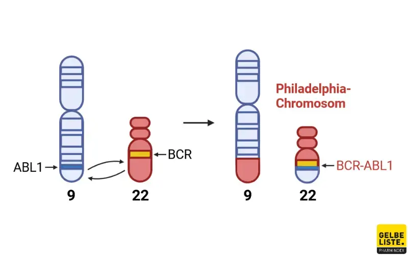Philadelphia-Chromosom-BCR-ABL1
