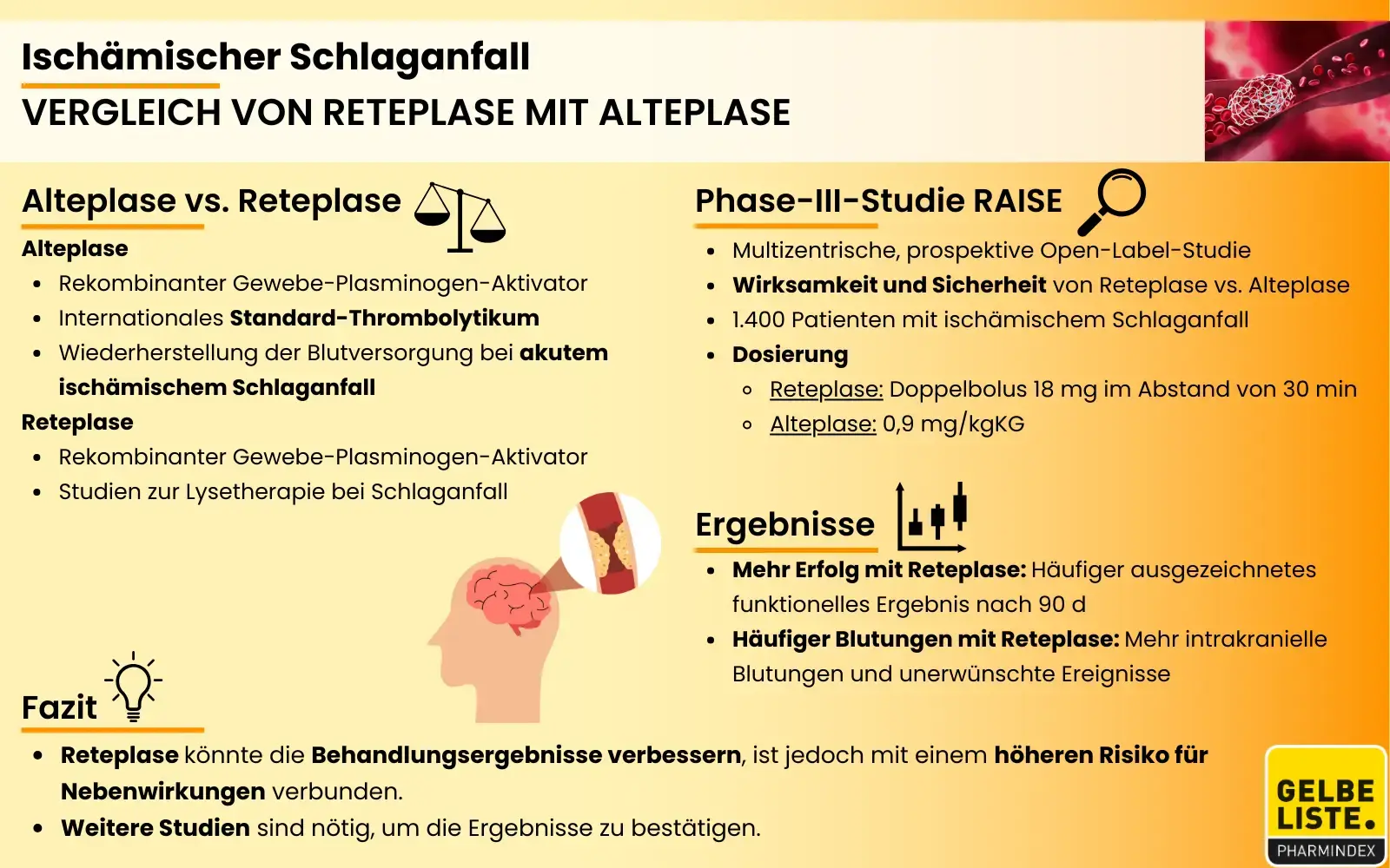 Vergleich Reteplase mit Alteplase bei Schlaganfall 