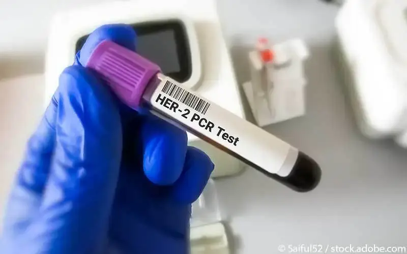her2-test