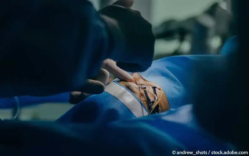 Intravitreale Injektion