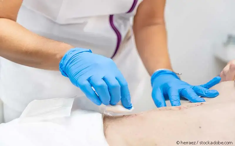 Wundversorgung Praxis